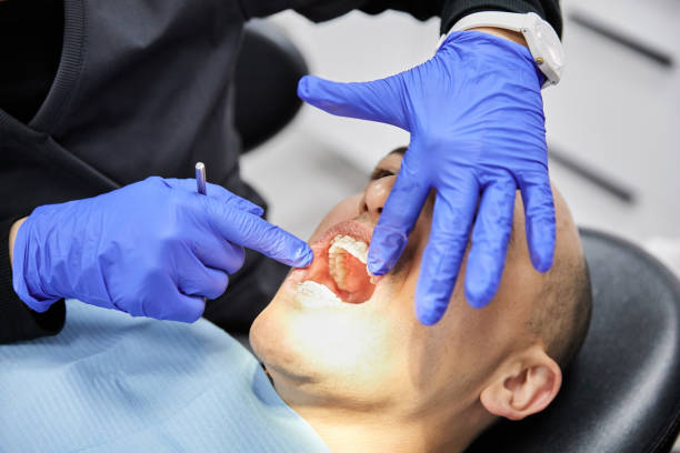 Best Emergency Broken Tooth Repair in Opp, AL