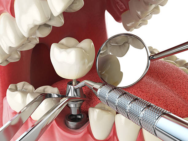  Opp, AL Emergency Dentist Pros